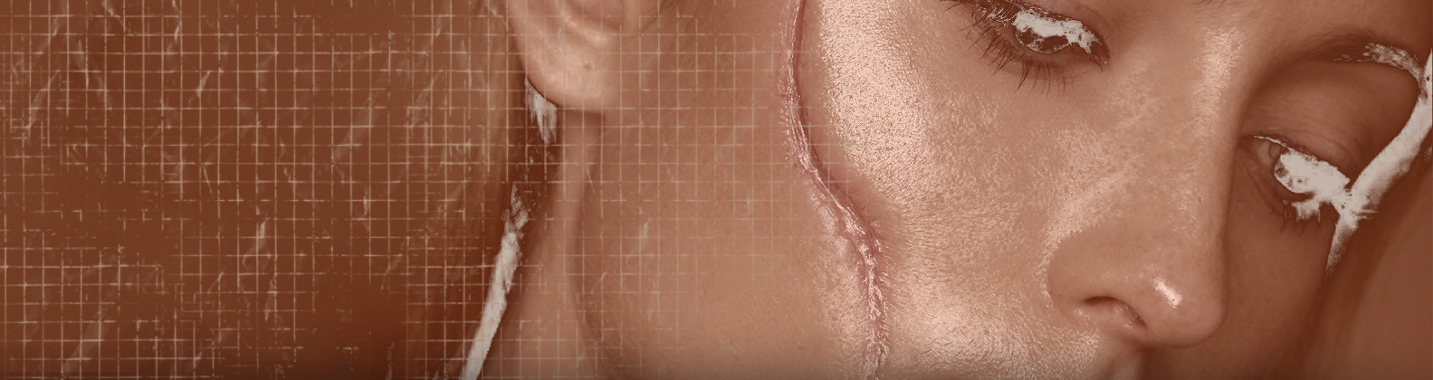 Cicatrizes e Quelóides | Dr. Rodrigo Pimenta Cirurgia Plástica em Fortaleza