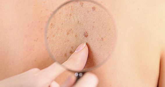 Lesões de pele - Dr. Rodrigo Pimenta