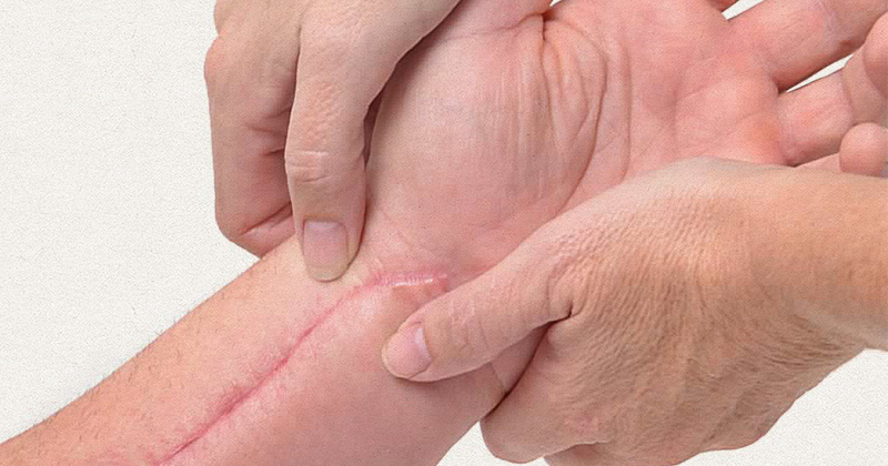 Cirurgia plástica para Cicatrizes e Quelóides | Dr. Rodrigo Pimenta
